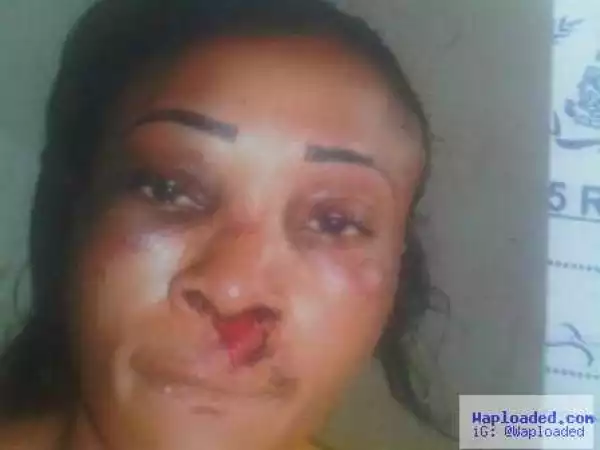 Photo: See What A Female Tenant Did To Her Landlady In Lagos Because Of Marijuana